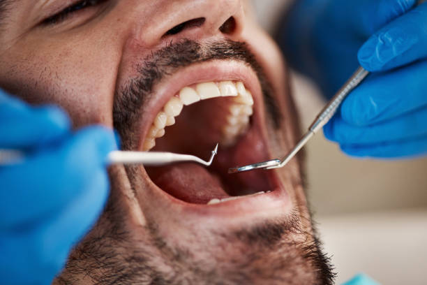 Best Tooth Infection Emergency Dentist  in Doolittle, TX
