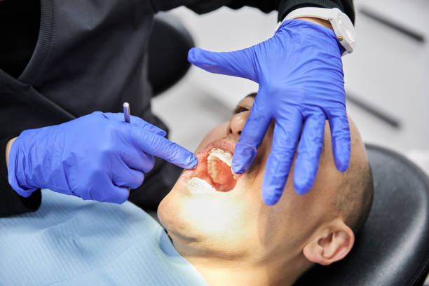 Best Dentist for Tooth Abscess  in Doolittle, TX