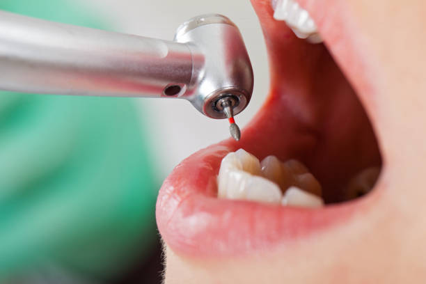 Best Emergency Gum Pain Relief  in Doolittle, TX